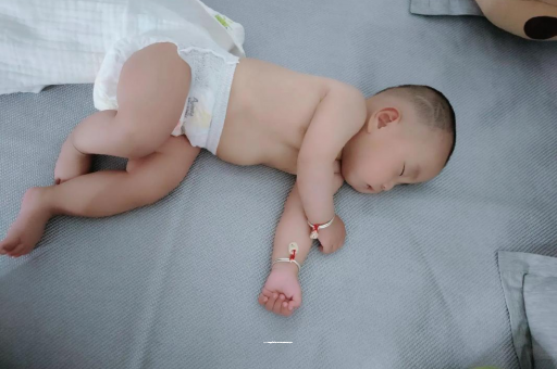 锡林郭勒六个月宝宝眼睛散光